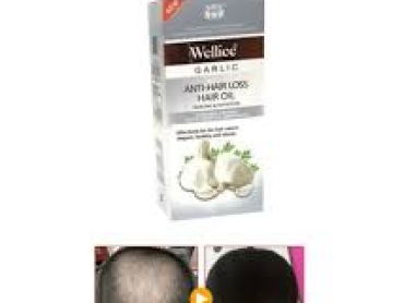 usage Wellice Garlic Anti-Hair Loss Serum
