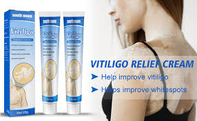 shop diabextan, Vitiligo Cream