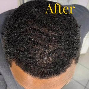 hairex, Generic Hair-EX For Hair Growth, hairex shampoo side effects, Hair EX Tonic Spray price In Kenya, HairEX Tonic reviews kenya, HairEX Tonic ingredients, HairEX Tonic shop nairobi central