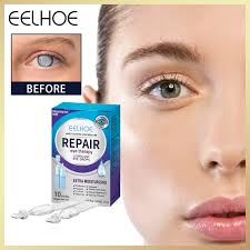 easy flex joint capsules, flexogor,sustafix, arthroneo, flekosteel, flexagon, collagenAX, Bioforce, hondrostrong forte, Lubricant Eye Repair Drops