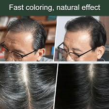 insulinol for sale in nairobi, Plant Extract Hair Dye