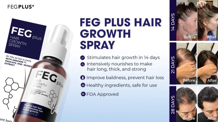 Where To Buy OUHOE Feg Hair Growth Spray In Kenya? HealthSupplementsKenya is the place to shop. In addition, the service for the customer is pleasant. Also, you can call them using telephone number +254723408602. However, you can visit their office in 2nd Floor Of Nacico Coop Chamber On Mondlane Street Opposite Imenti House