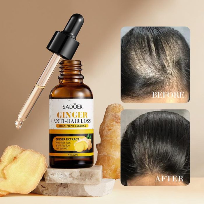 Sadoer hair growth serum how to use,Sadoer hair growth serum reviews,Sadoer hair growth serum before and after